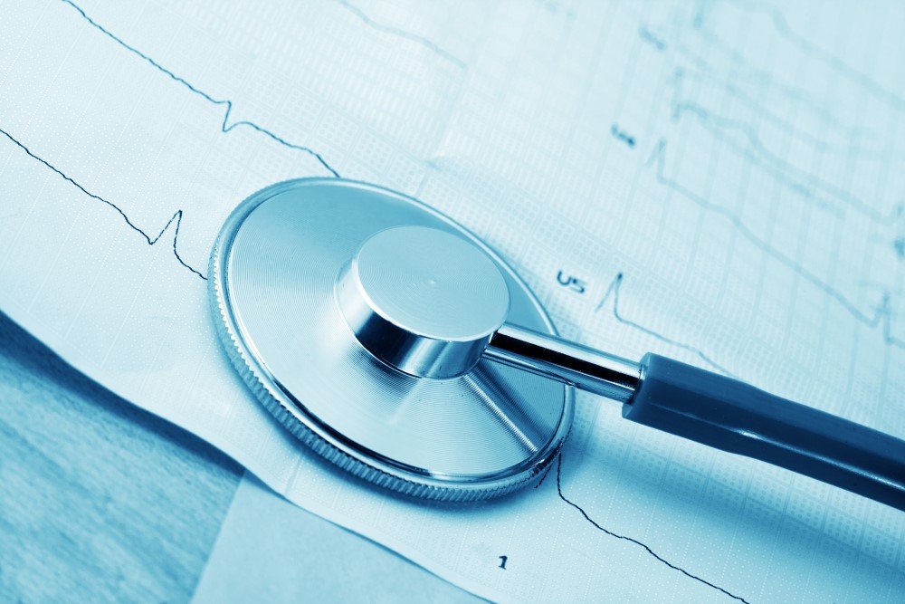 Echocardiogram