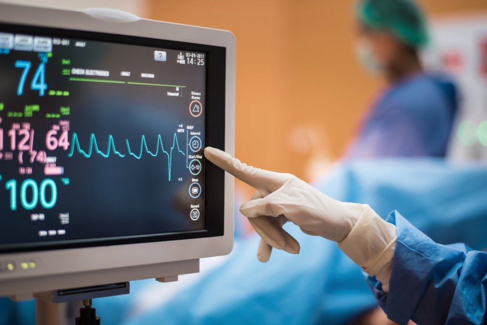 Electrocardiogram (ECG)