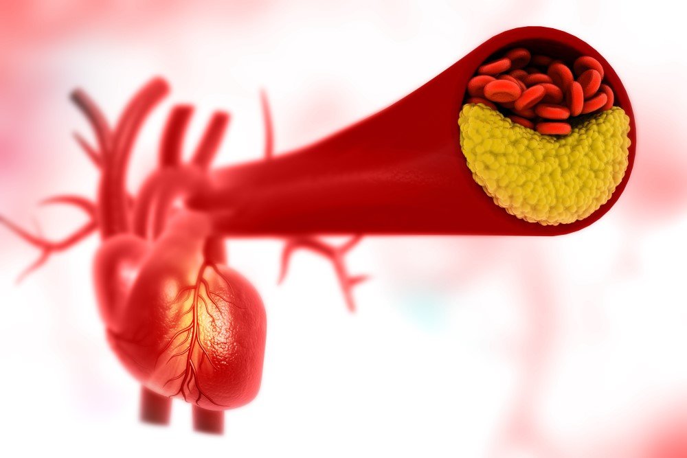 Peripheral Arterial Disease Tests